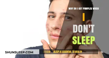 Sleep Deprivation and Skin: Unraveling the Pimple Connection