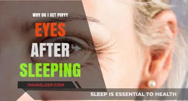 Why Do I Wake Up with Puffy Eyes? Causes and Solutions
