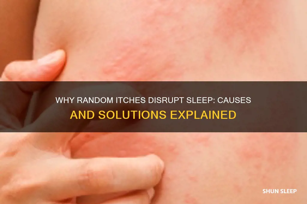 why do i get random itches when trying to sleep