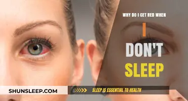 Sleep Deprivation and Redness: Understanding the Link to Your Skin