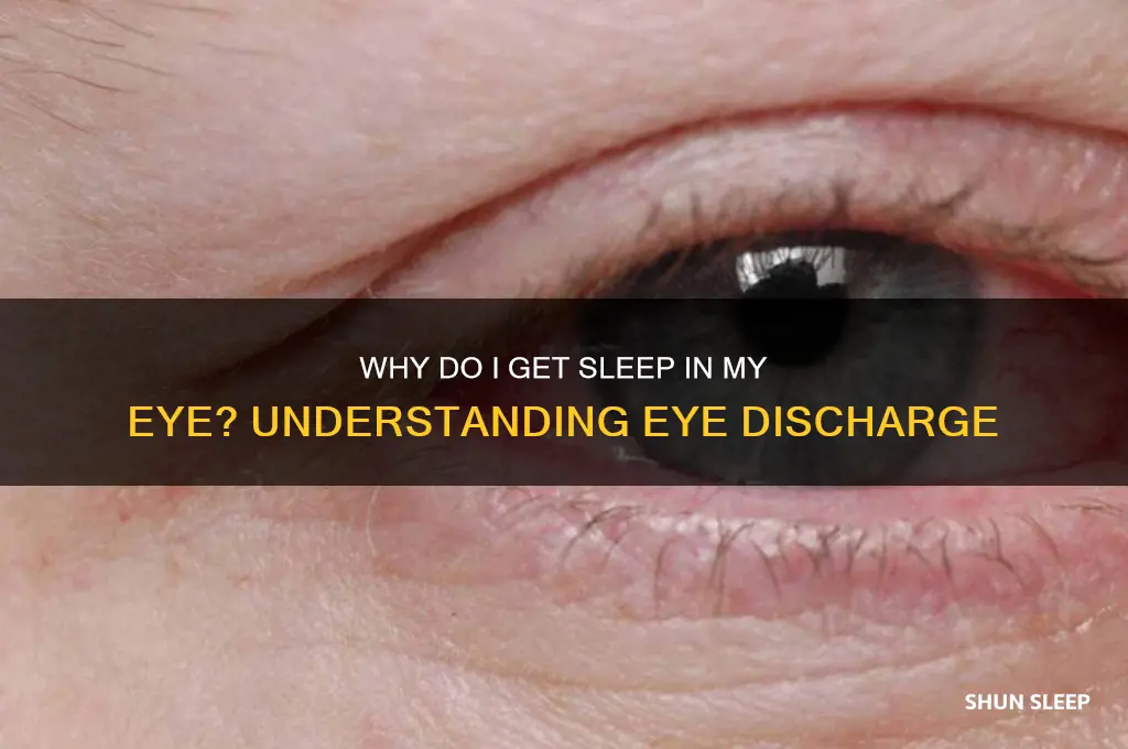 why do i get sleep in my eye