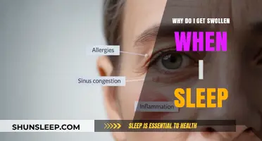 Why Do I Wake Up Swollen? Understanding Sleep-Related Edema Causes