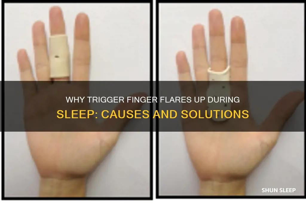 why do i get trigger finger when i sleep