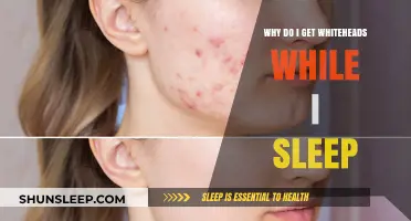 Why Do Whiteheads Appear Overnight? Understanding Sleep-Related Breakouts