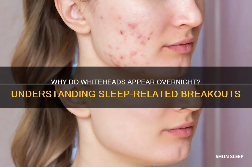 why do i get whiteheads while i sleep
