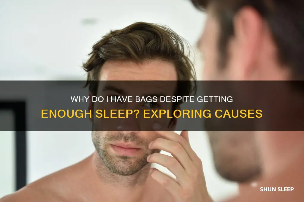 why do i have bags if i get enough sleep