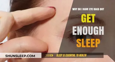 Why Do I Have Eye Bags Despite Getting Enough Sleep?