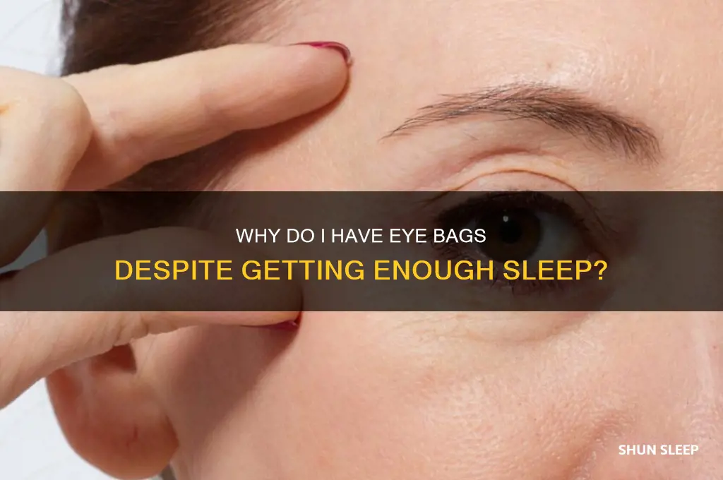 why do i have eye bags but get enough sleep