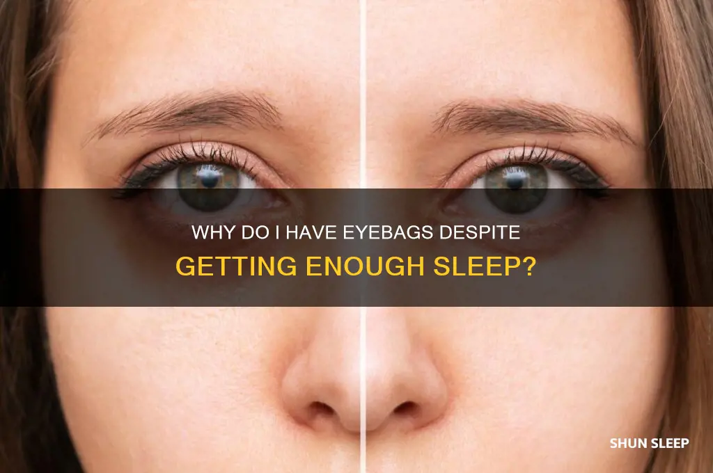 why do i have eyebags if i get enough sleep