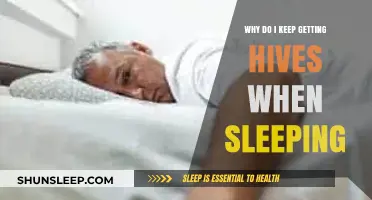 Nighttime Hives: Uncovering Causes and Solutions for Sleep-Related Rashes
