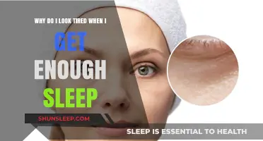 Why Do I Look Tired Despite Getting Enough Sleep? Uncovering Causes