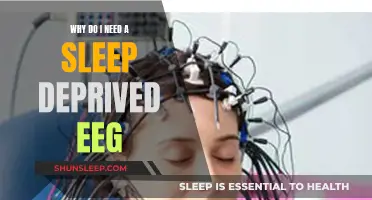 Sleep-Deprived EEG: Why It's Necessary for Diagnosis
