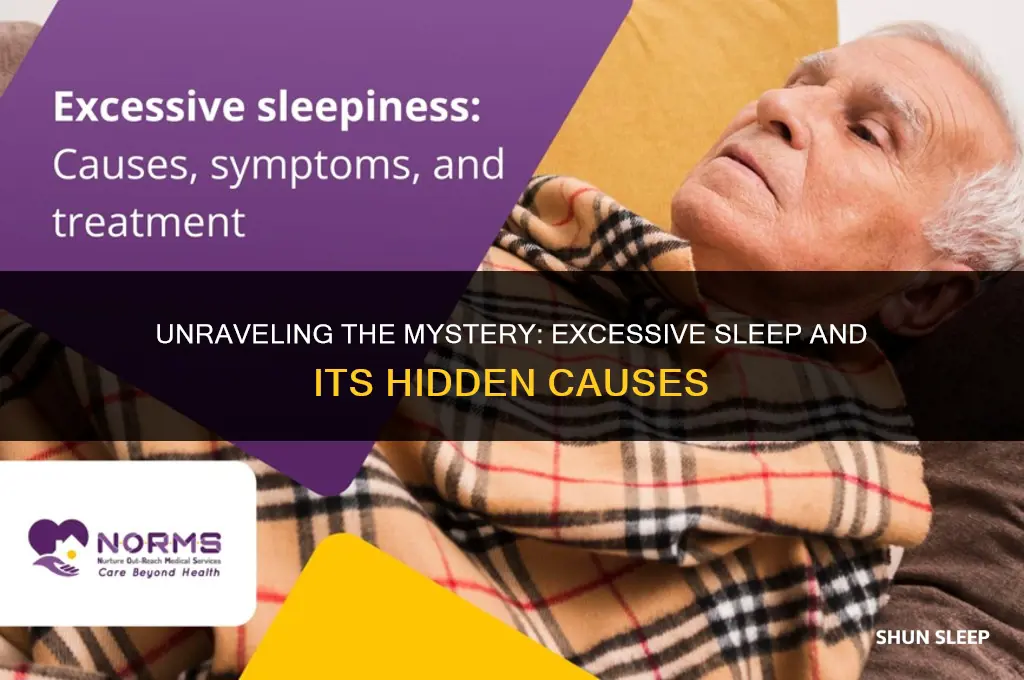 why do i sleep for 14 hours