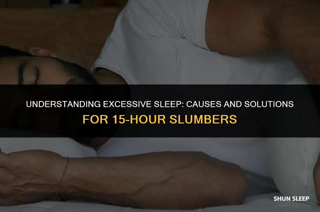 why do i sleep for 15 hours