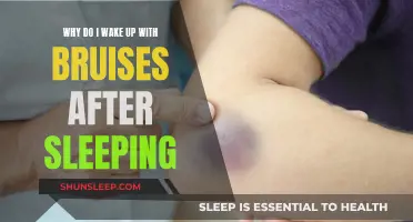 Unexplained Bruises After Sleep: What Your Body Is Telling You