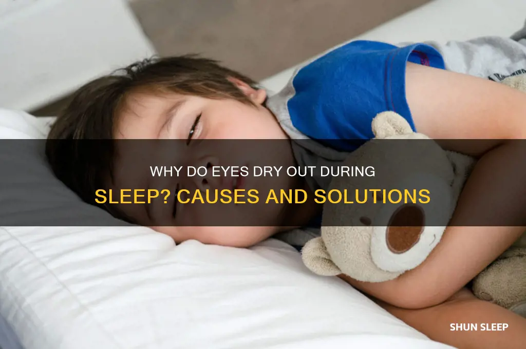 why do my eyes get dry when i sleep