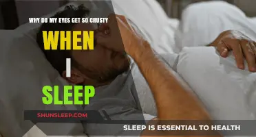 Why Do My Eyes Get Crusty When I Sleep? Causes & Solutions