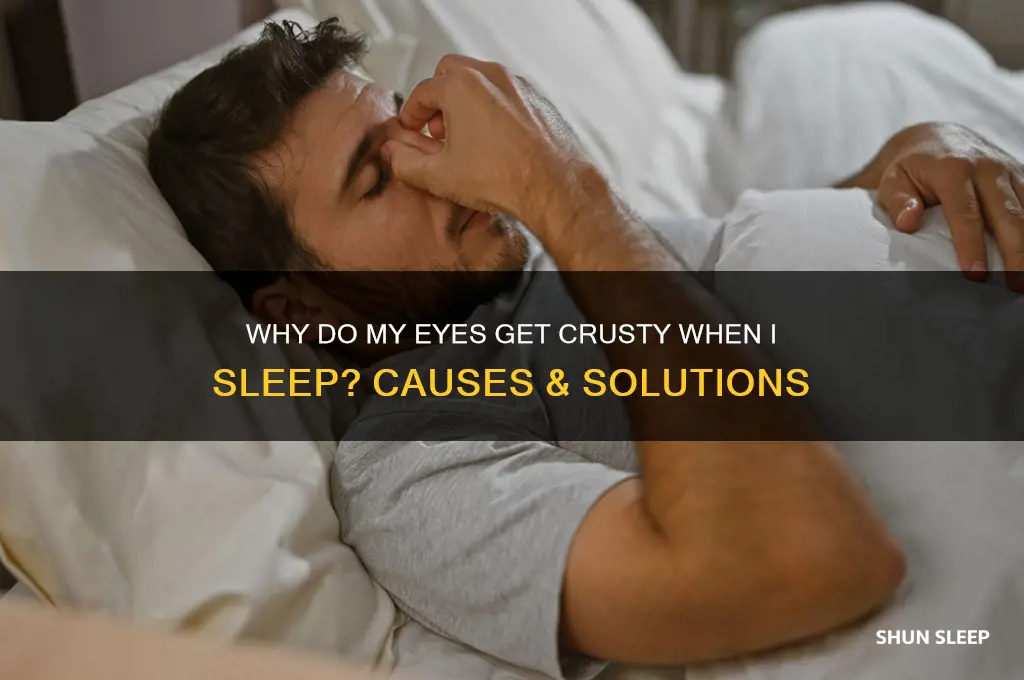 why do my eyes get so crusty when i sleep