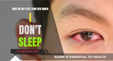 Sleep Deprivation: Red Eyes and You