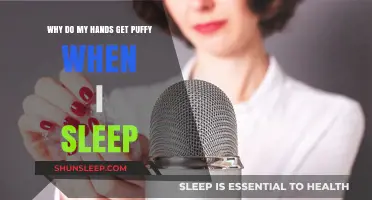 Why Do My Hands Get Puffy When I Sleep? Causes and Solutions