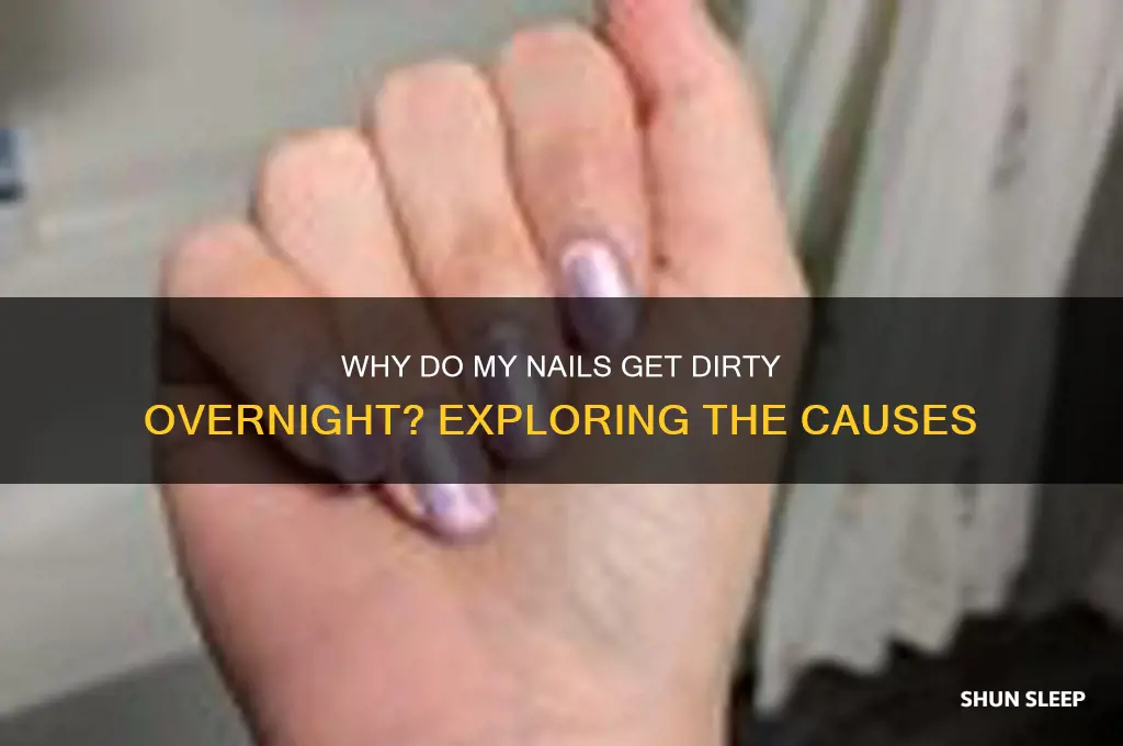 why do my nails get dirty when i sleep