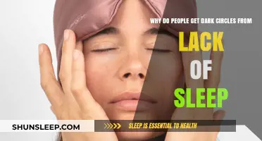 Sleep Deprivation and Dark Circles: Uncovering the Tired Eye Connection