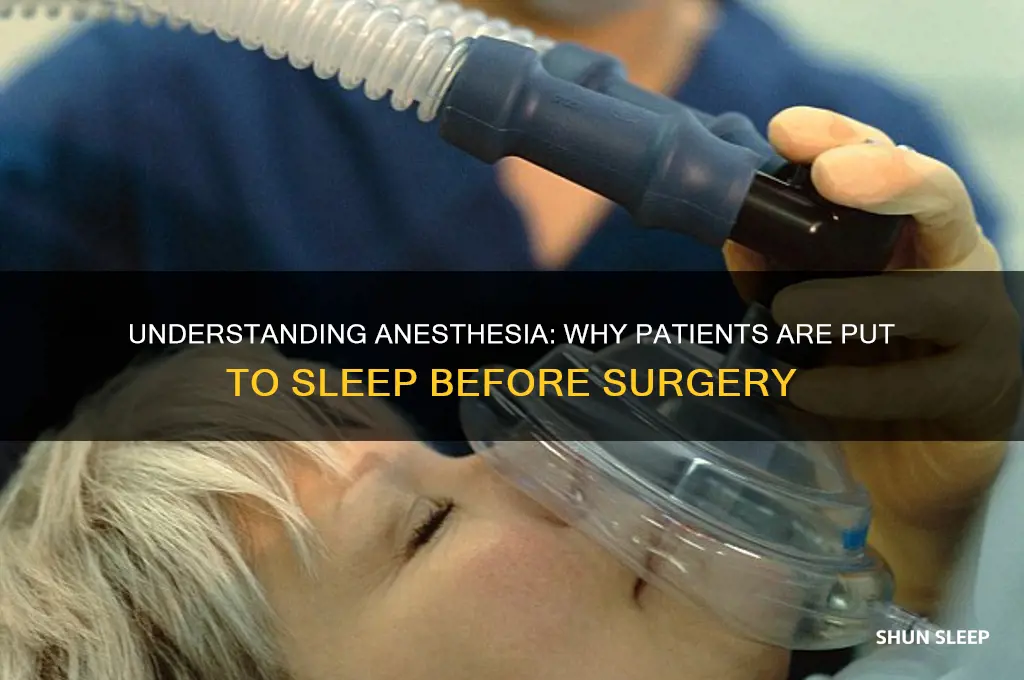 why do people get put to sleep before surgery