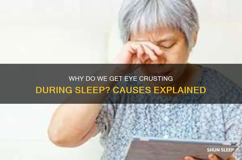 why do we get eye crest while sleeping