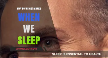 Why Do We Wake Up with Sleep Marks? Understanding Overnight Skin Impressions