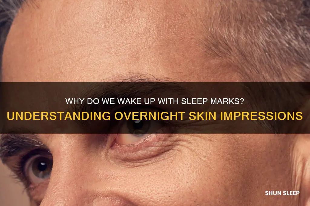 why do we get marks when we sleep