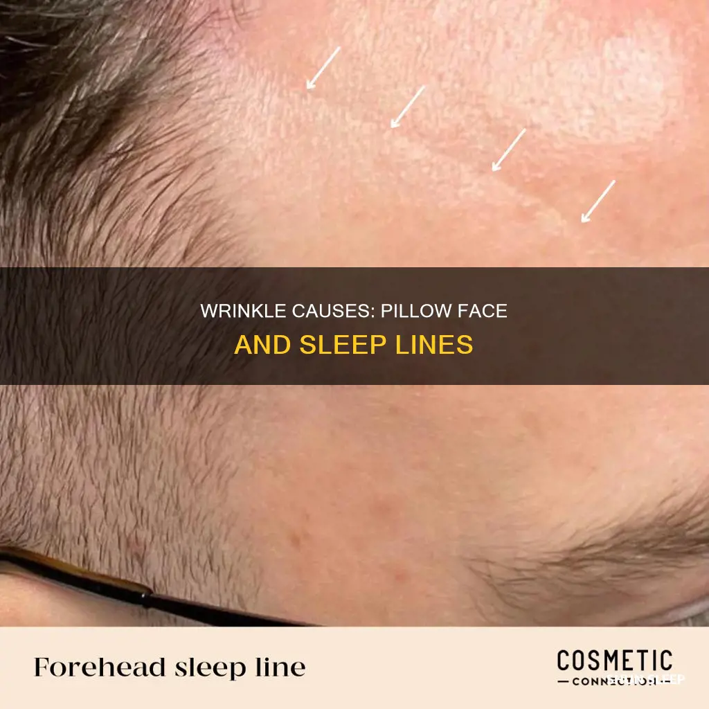 why do wrinkles after sleep was that means
