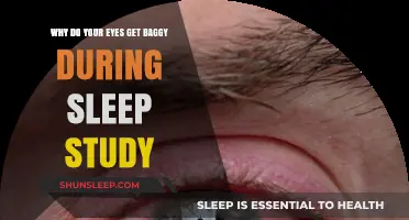 Why Sleep Studies Cause Puffy Eyes: Understanding the Science Behind It