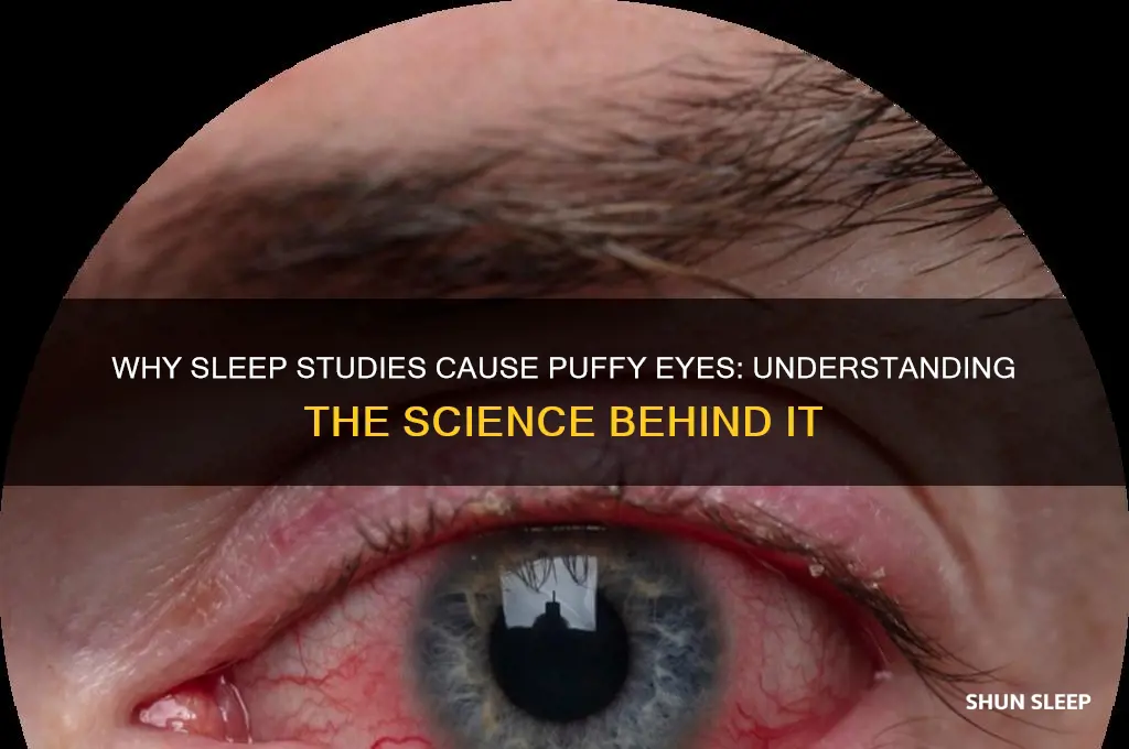 why do your eyes get baggy during sleep study