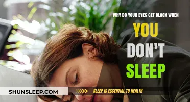 Sleep Deprivation and Dark Circles: Uncovering the Science Behind Tired Eyes
