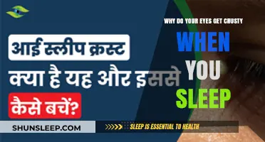 Why Do Eyes Get Crusty During Sleep? Causes and Solutions