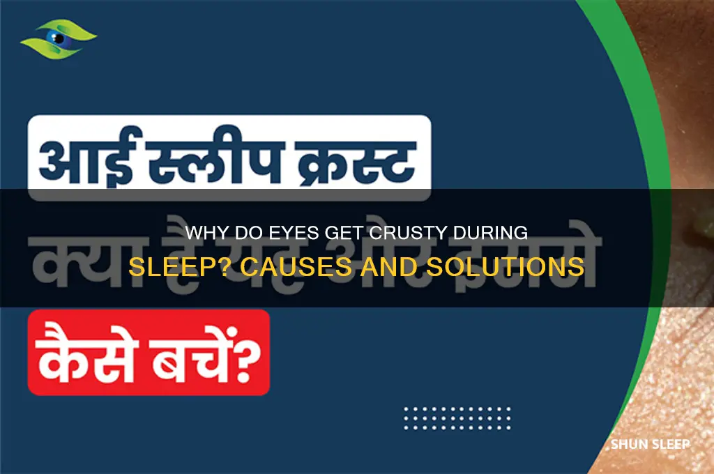 why do your eyes get crusty when you sleep