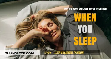 Why Do Eyes Stick Together During Sleep? Causes and Solutions