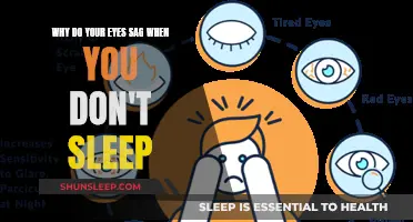 Sleep Deprivation: Sagging Eyes and How to Prevent It