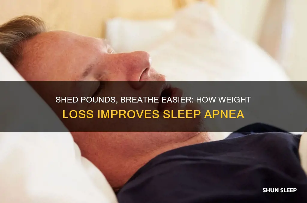 why does losing weight help sleep apnea