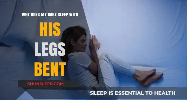Why Do Babies Sleep with Bent Legs? Understanding Your Baby's Sleep Position