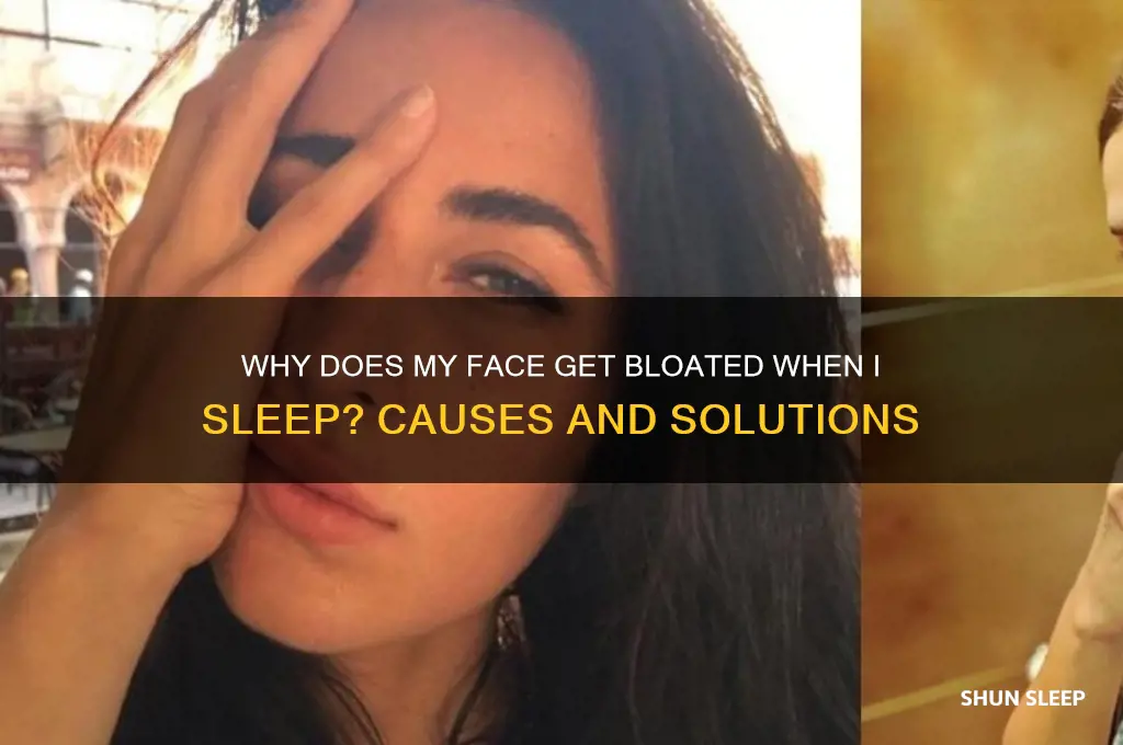 why does my face get bloated when i sleep