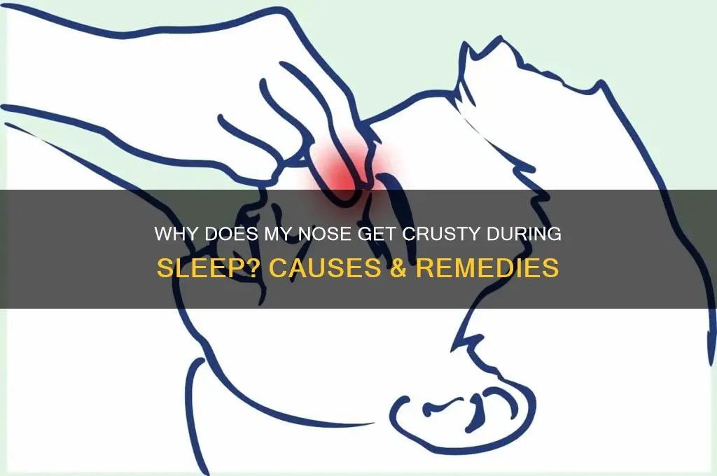 why does my nose get all crusty while i sleep