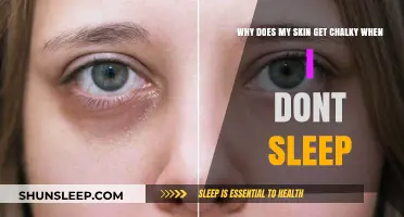 Lack of Sleep and Chalky Skin: Understanding the Connection