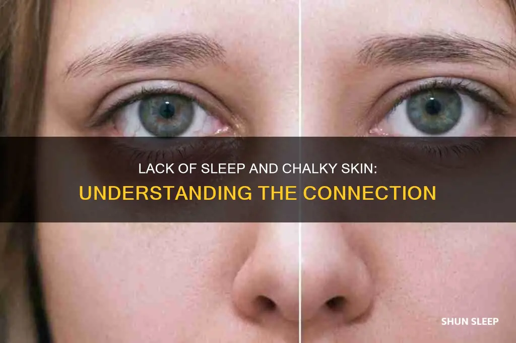 why does my skin get chalky when i dont sleep
