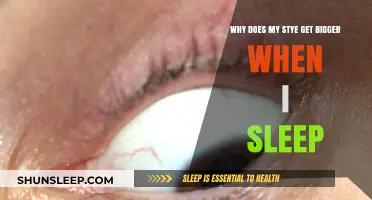 Why Your Stye Grows Overnight: Causes and Sleep-Related Triggers