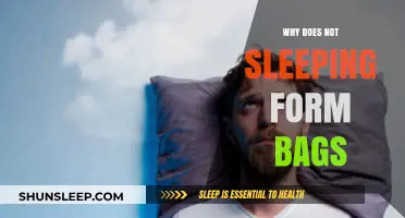 Sleep Deprivation: Understanding the Cause of Under-Eye Bags
