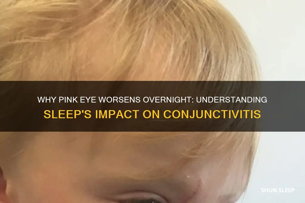 why does pink eye get worse when i sleep