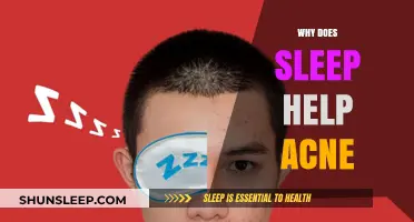 Sleep and Clear Skin: How Rest Fights Acne Effectively