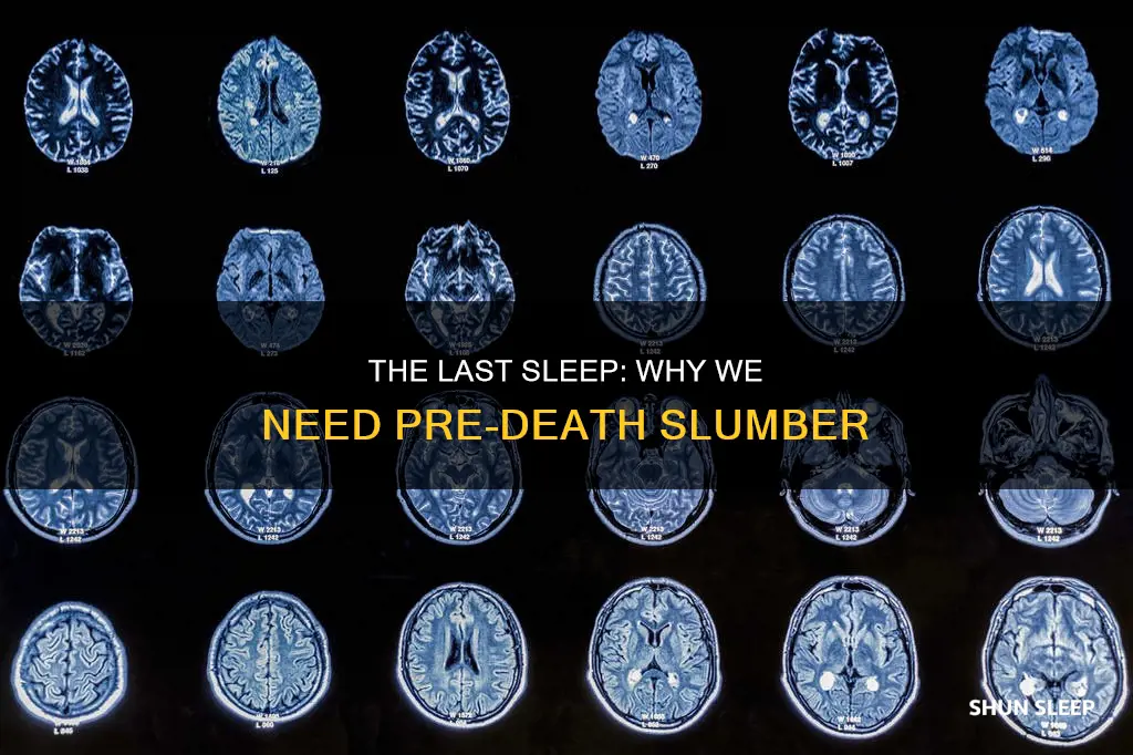 why does someone need to sleep before they die