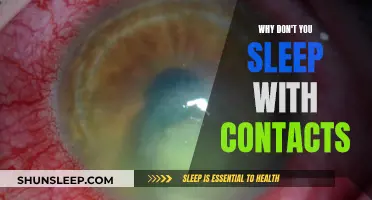 Sleeping with Contacts: Risky Business for Your Eyes